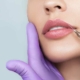 Natürlich volle Lippen | Hautarztpraxis Berlin - Dr. Reytan